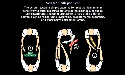 scratch collapse test